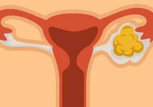 茂名卵试管：新生儿大便有血丝：如何正确处理很重要！